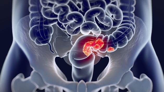 Webinar mdl afbeelding